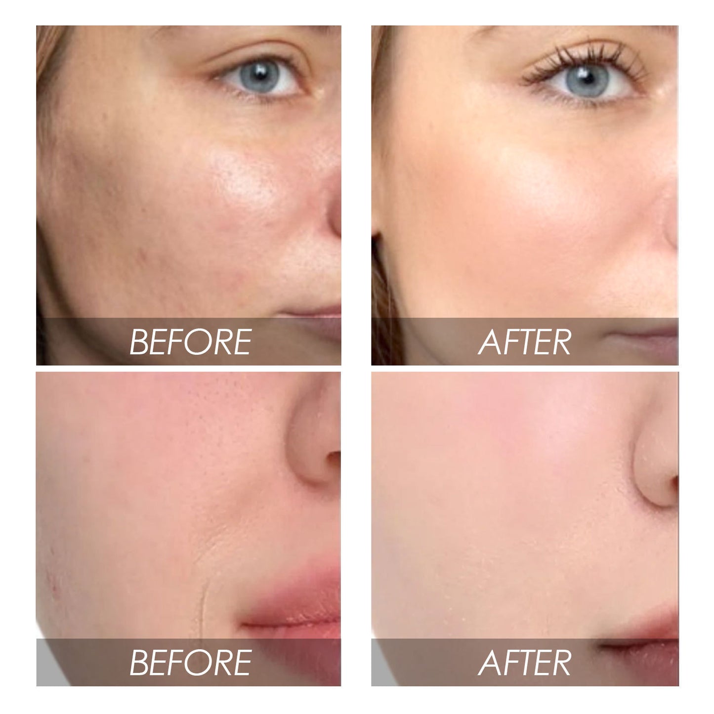 Avocado Watermelon Facial Fading Wrinkle Liquid